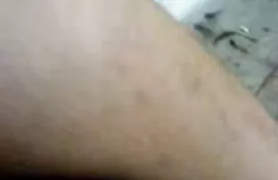 अभिनेता श्यामला मुश्किल सेक्सी बीपी पिक्चर ओपन